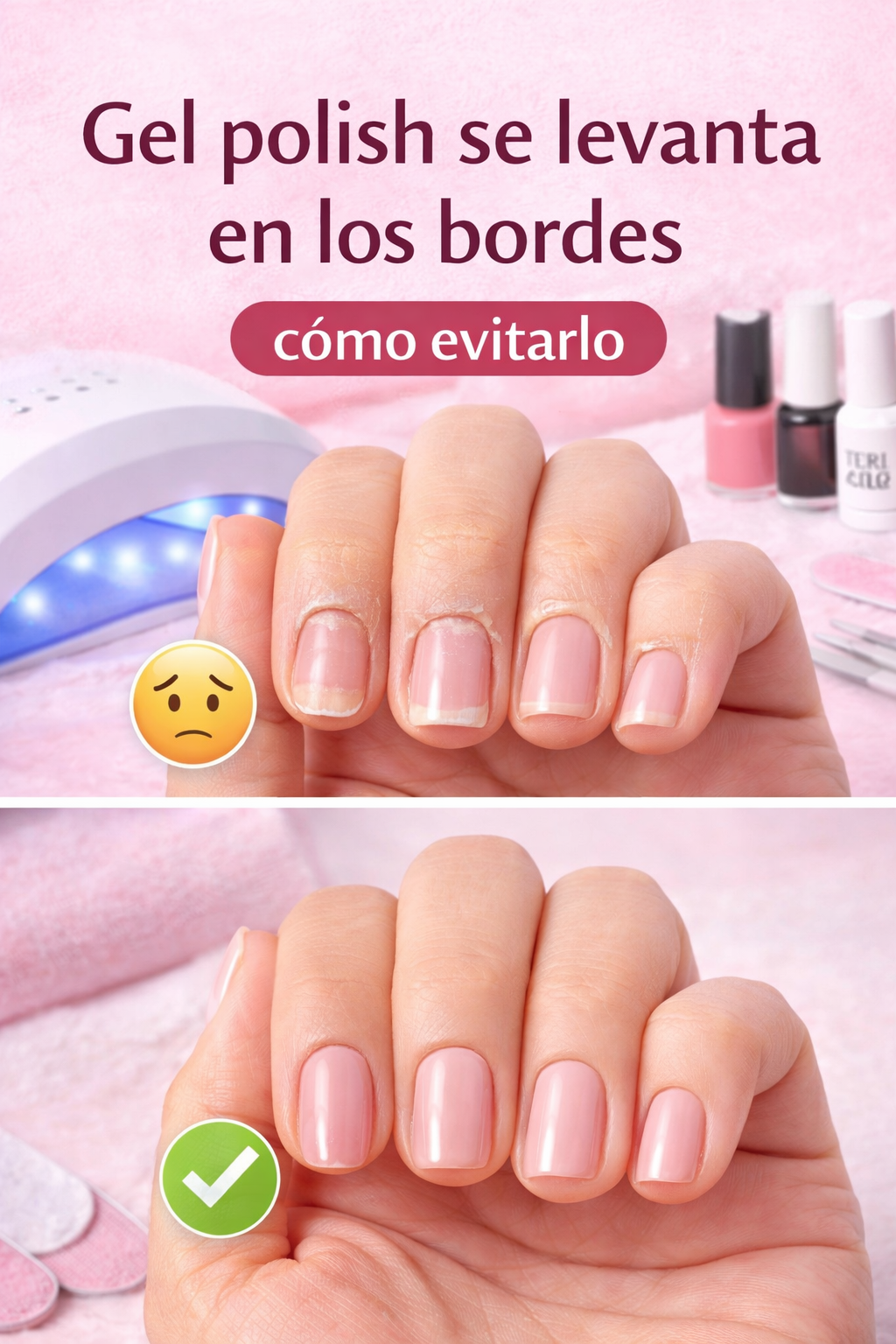Gel polish levantado en los bordes comparado con uñas en gel bien aplicadas mostrando cómo evitar que el esmalte gel se despegue