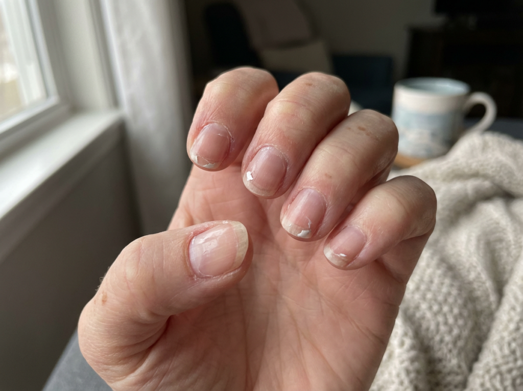 uñas en gel se levantan por los lados y en la cutícula