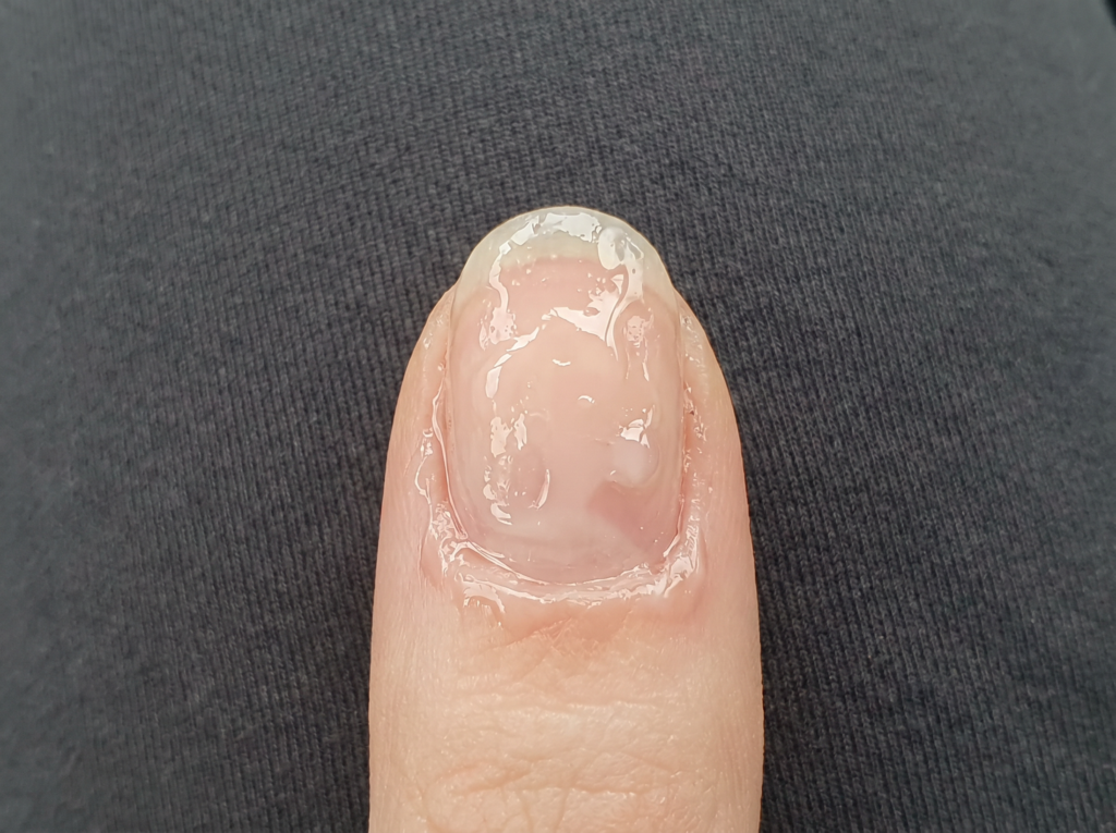capa gruesa de gel que puede dejar uñas onduladas y poco profesionales